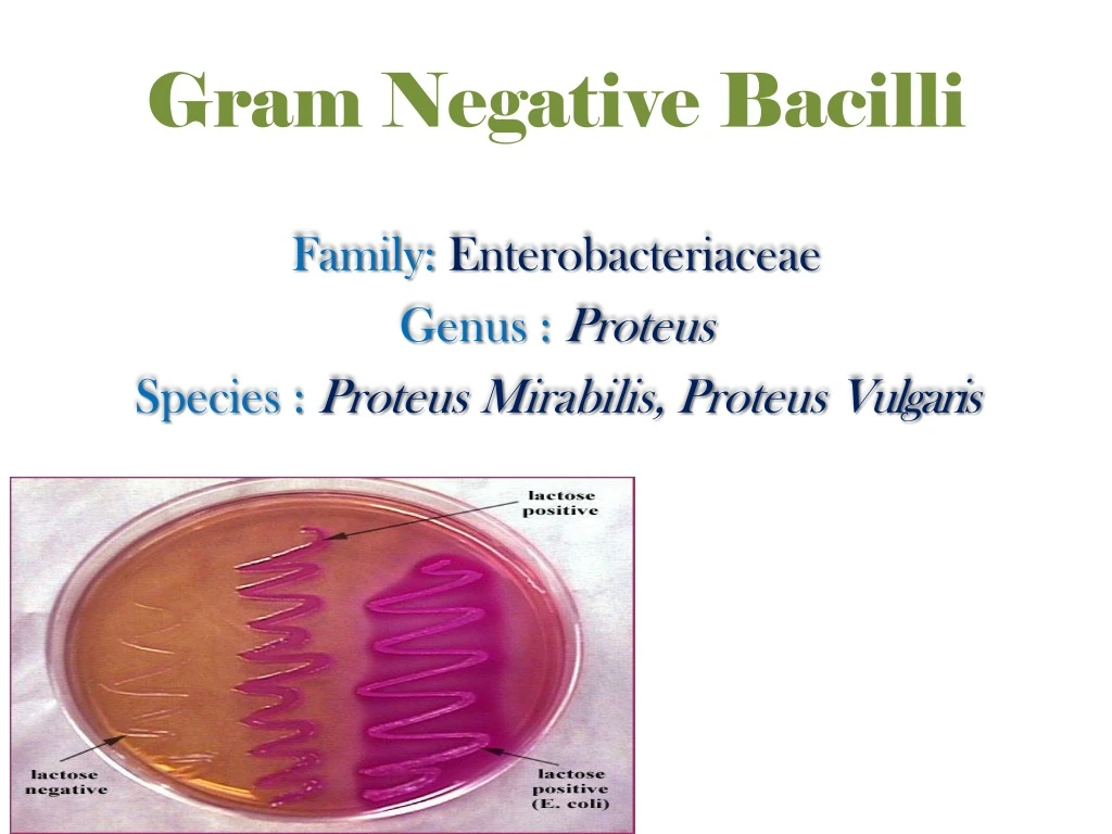 gram negative bacilli