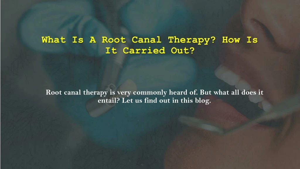 what is a root canal therapy how is it carried out
