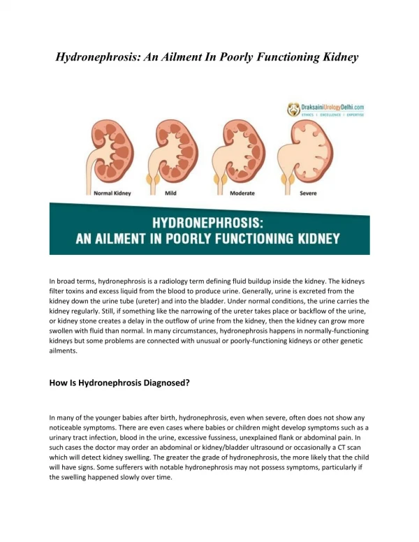 Hydronephrosis: An Ailment In Poorly Functioning Kidney
