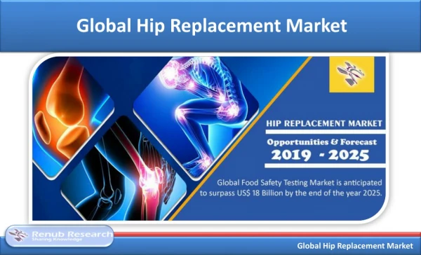 Global Hip Replacement Market is US$ 7 Billion by 2025