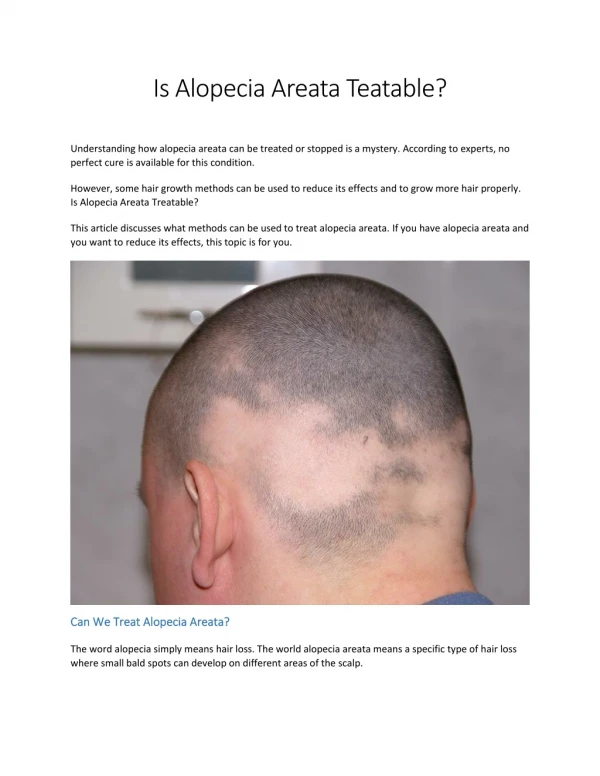 Is Alopecia Areata Teatable?