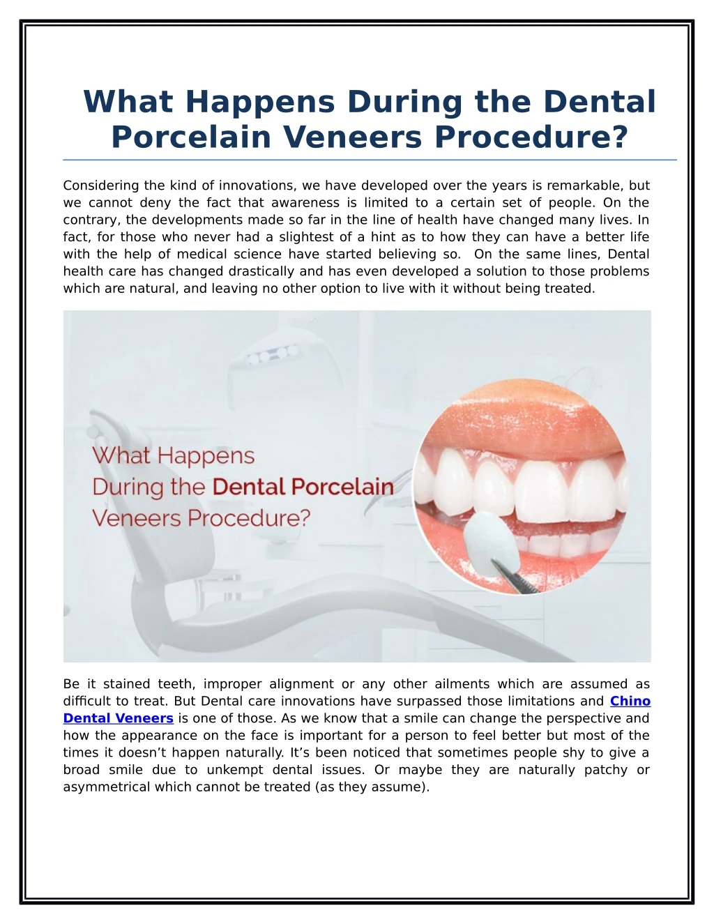 what happens during the dental porcelain veneers
