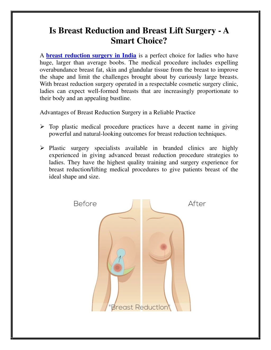 is breast reduction and breast lift surgery