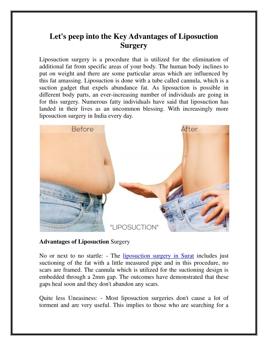 let s peep into the key advantages of liposuction