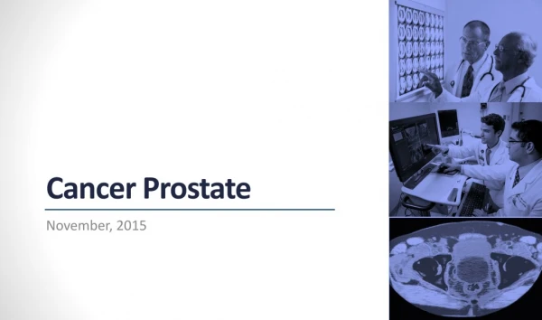Cancer Prostate