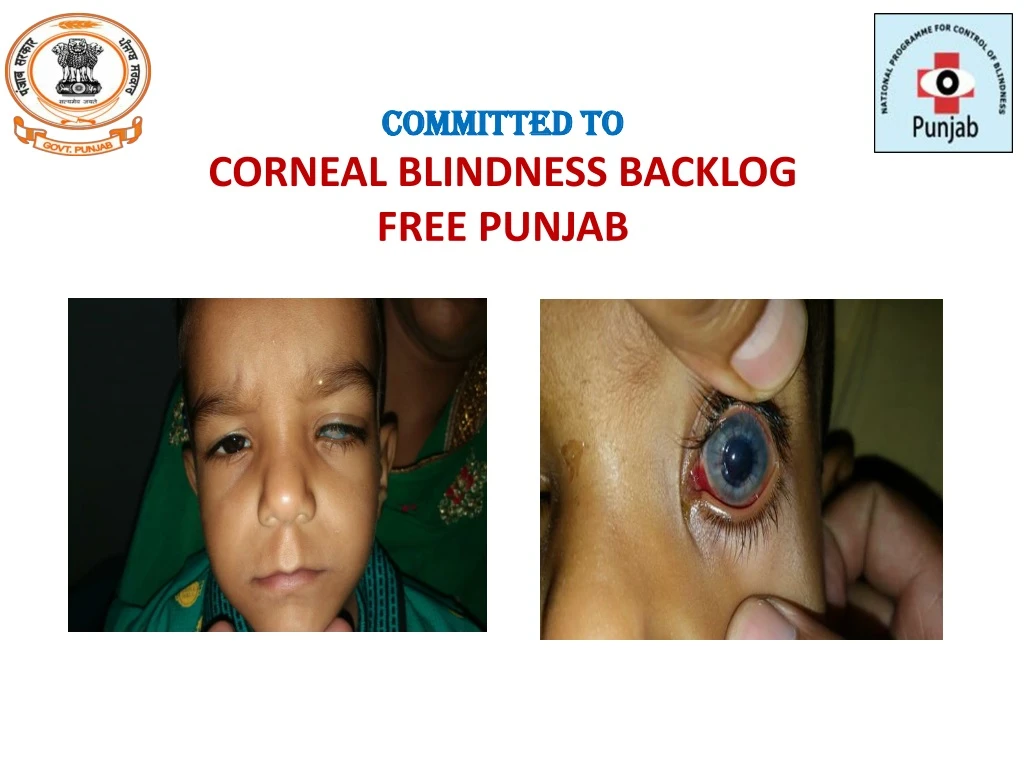 committed to corneal blindness backlog free punjab