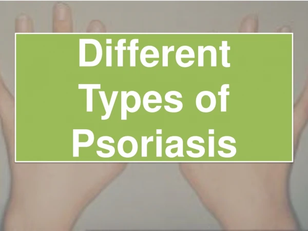 Different Types of Psoriasis