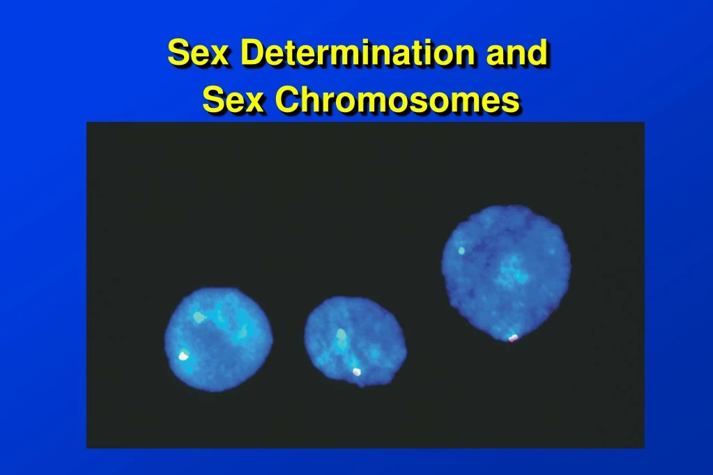 sex determination and sex chromosomes