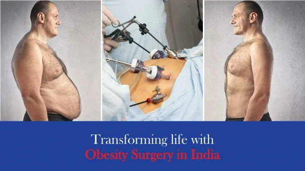 Transforming life with Obesity Surgery in India