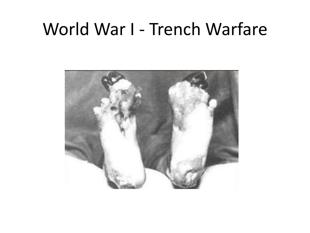 world war i trench warfare