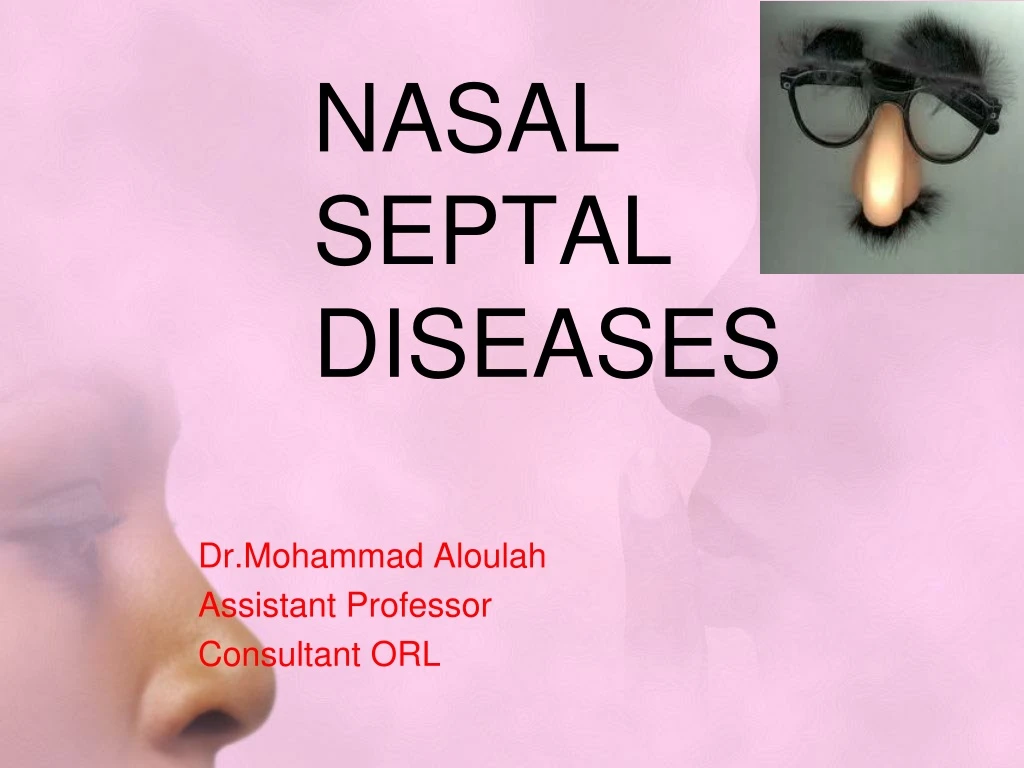 nasal septal diseases