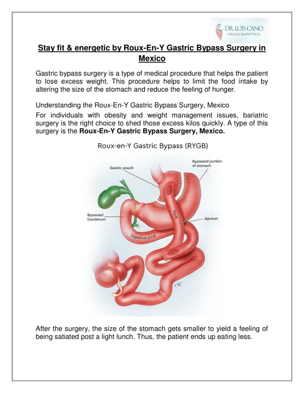 Stay fit & energetic by Roux-En-Y Gastric Bypass Surgery in Mexico