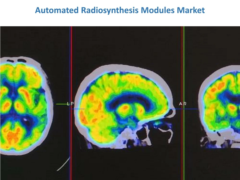 automated radiosynthesis modules market