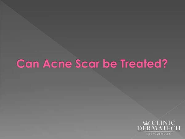 Can Acne scar be treated? | Clinic Dermatech