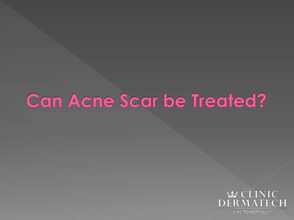 can acne scar be treated