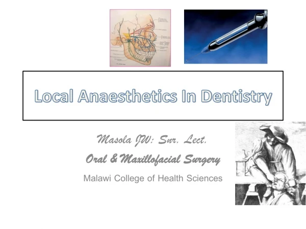 Local Anaesthetics In Dentistry