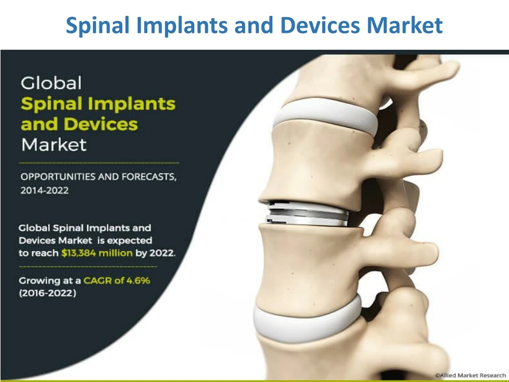spinal implants and devices market