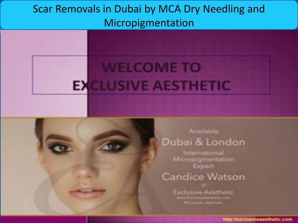 scar removals in dubai by mca dry needling