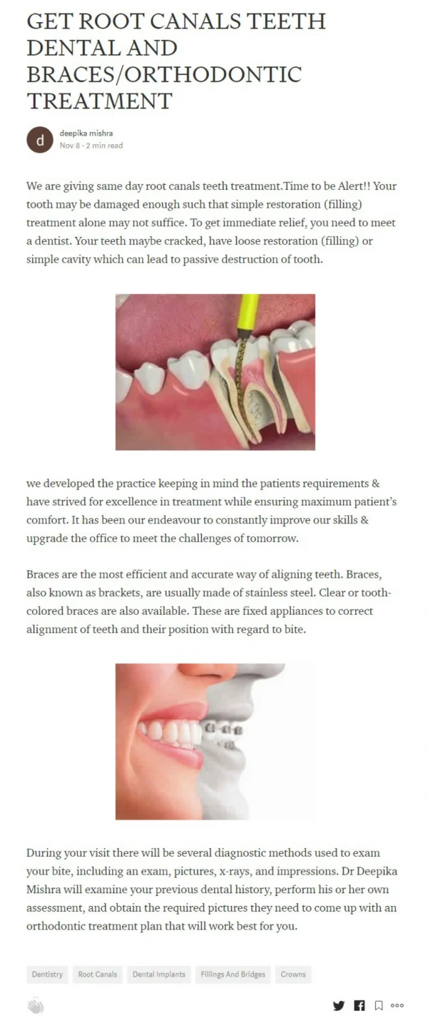 GET ROOT CANALS TEETH DENTAL AND BRACES/ORTHODONTIC TREATMENT