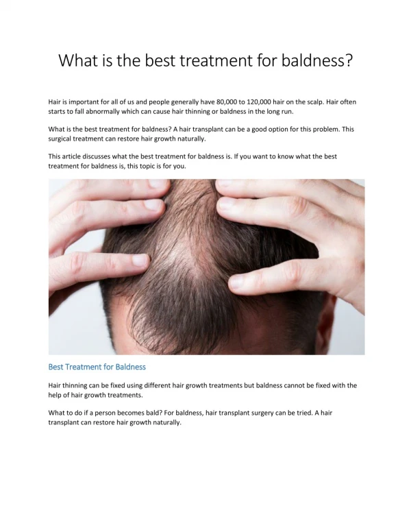 What is the best treatment for baldness?