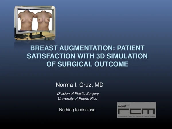 Breast Augmentation: Patient Satisfaction with 3D Simulation of surgical outcome