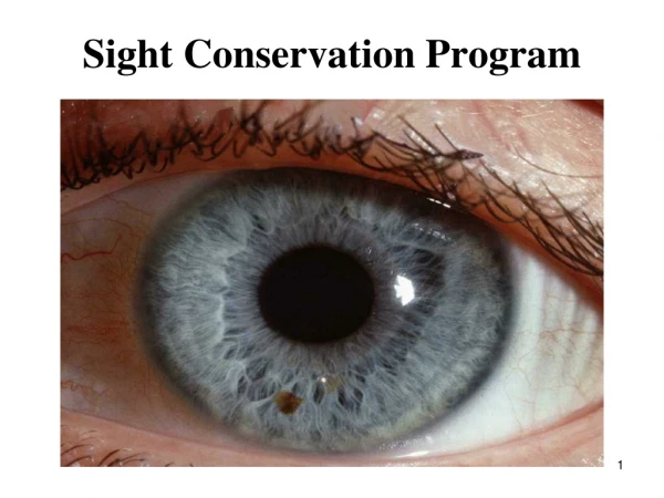 Sight Conservation Program