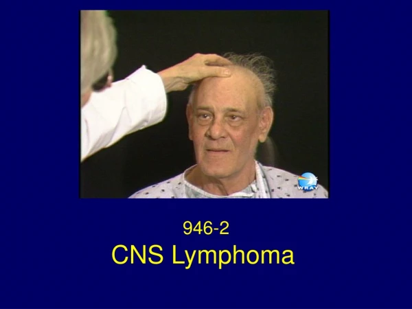 CNS Lymphoma