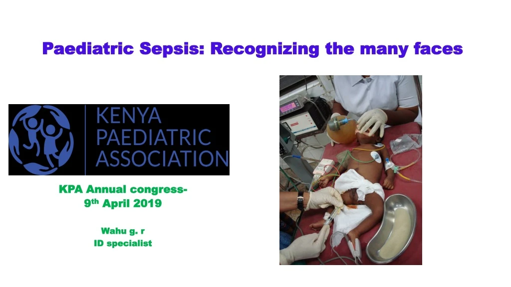 paediatric sepsis recognizing the many faces