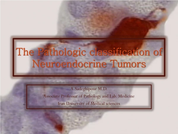 The Pathologic classification of Neuroendocrine Tumors