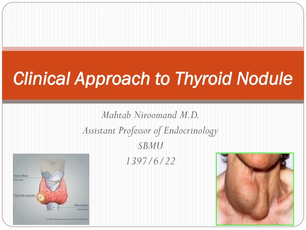 clinical approach to thyroid nodule