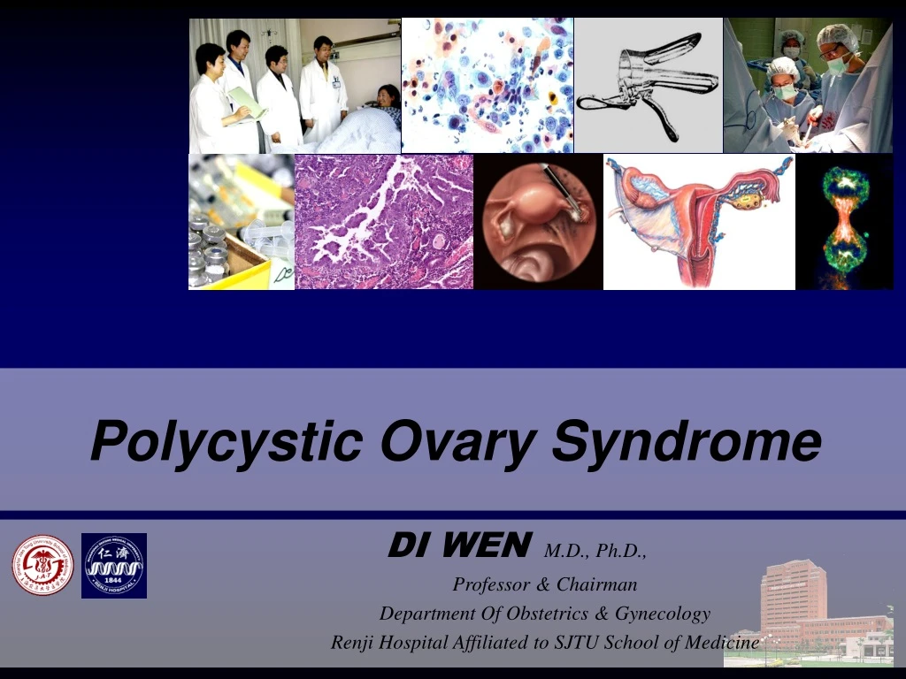 polycystic ovary syndrome