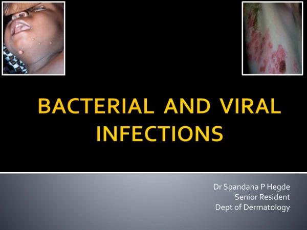 BACTERIAL AND VIRAL INFECTIONS