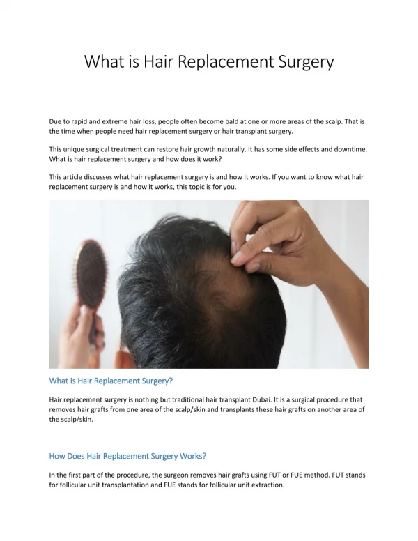 What is Hair Replacement Surgery