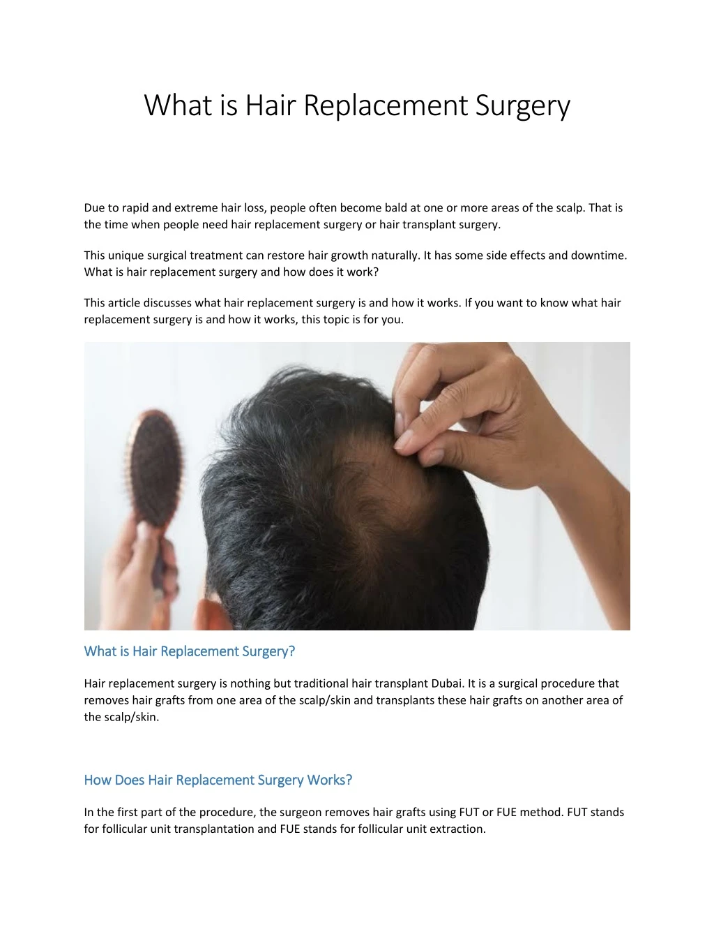 what is hair replacement surgery