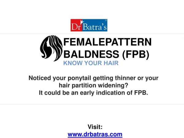 Female Pattern Baldness