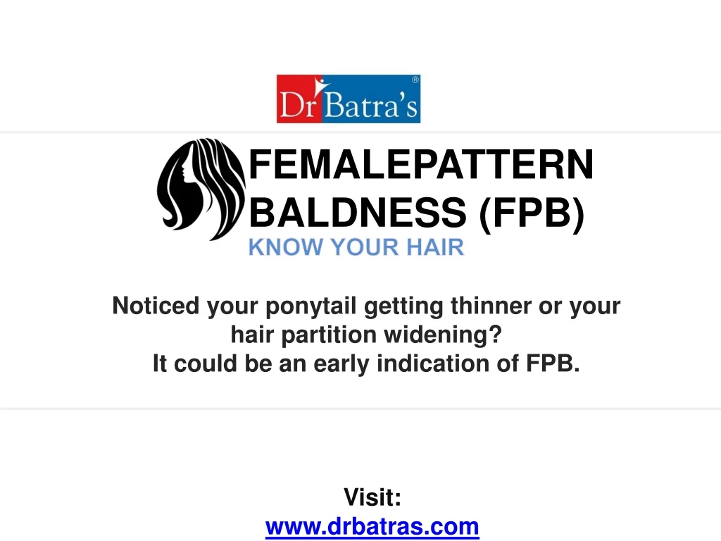 femalepattern baldness fpb