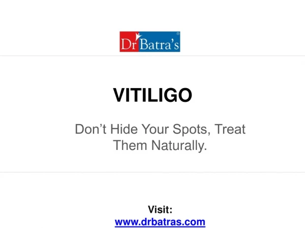 Vitiligo