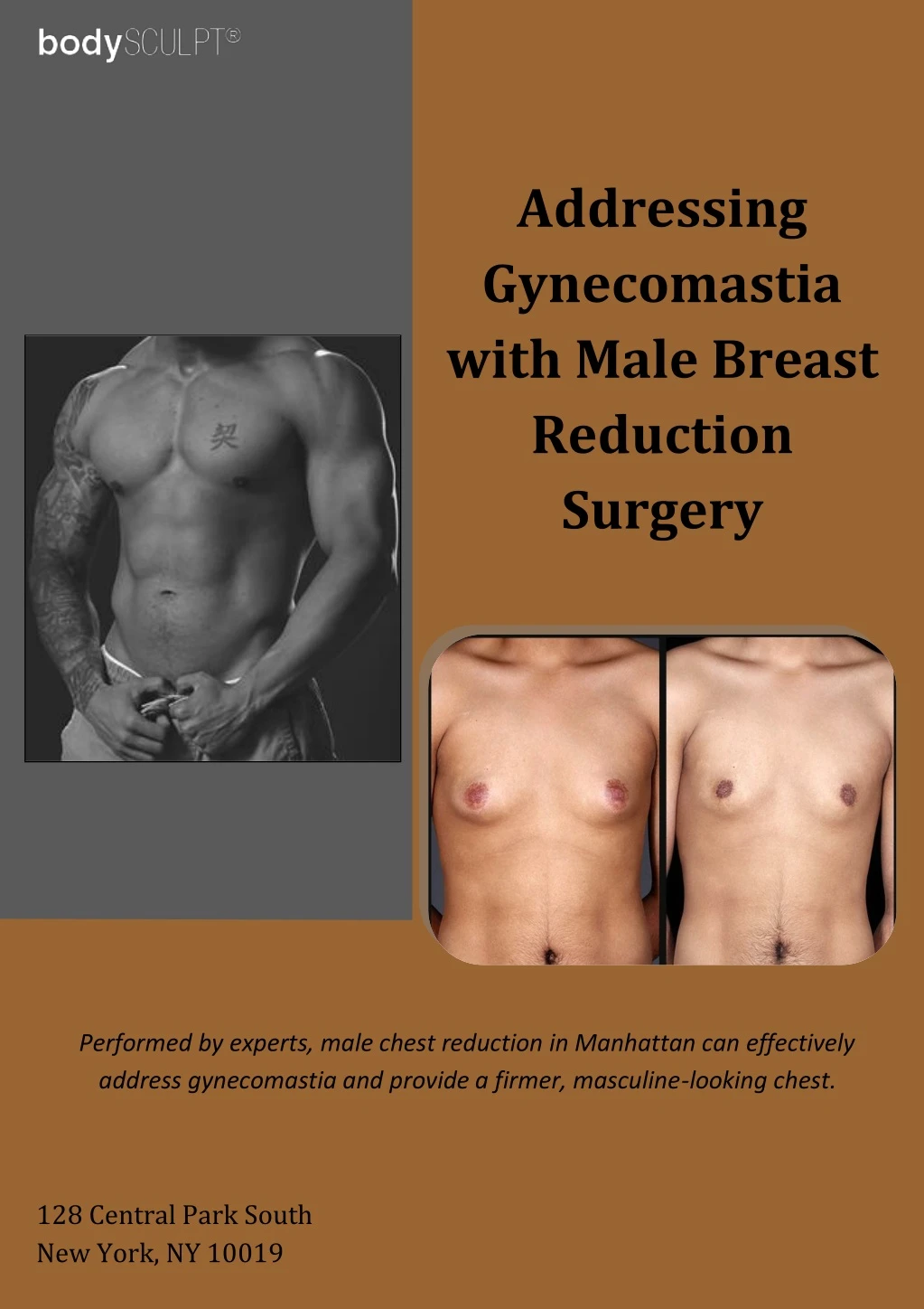 addressing gynecomastia with male breast