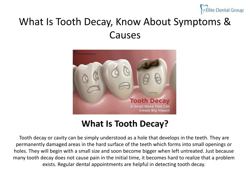 what is tooth decay know about symptoms causes