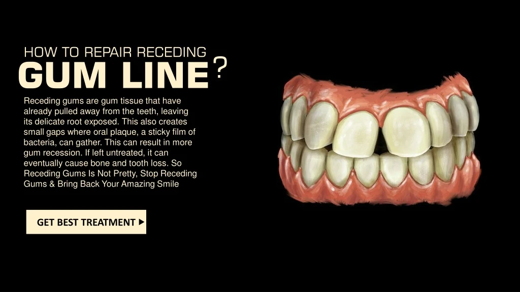 how to repair receding gum line receding gums