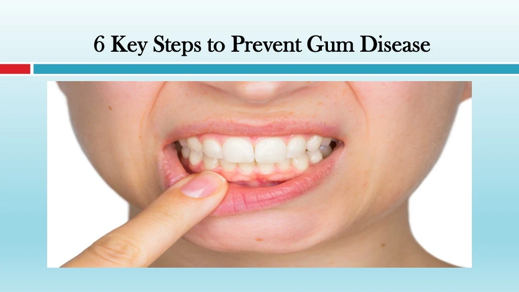 6 key steps to prevent gum disease