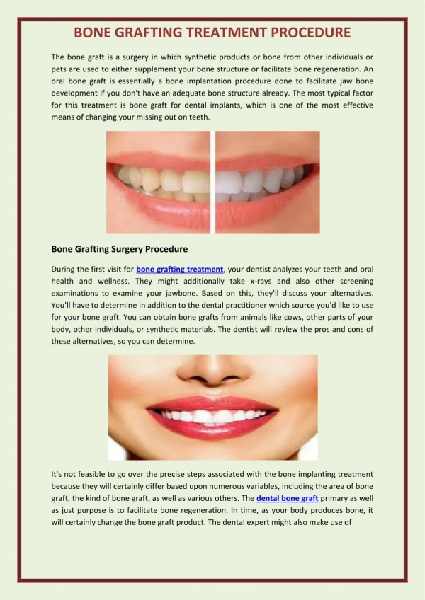 bone grafting treatment procedure