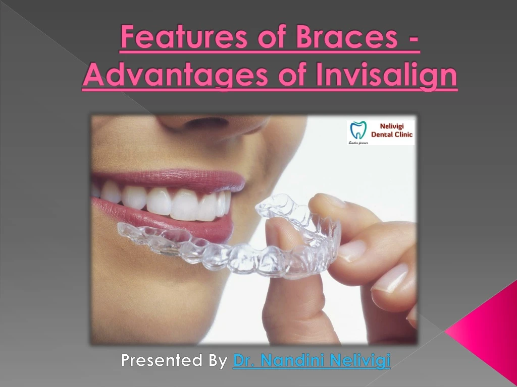 features of braces advantages of invisalign