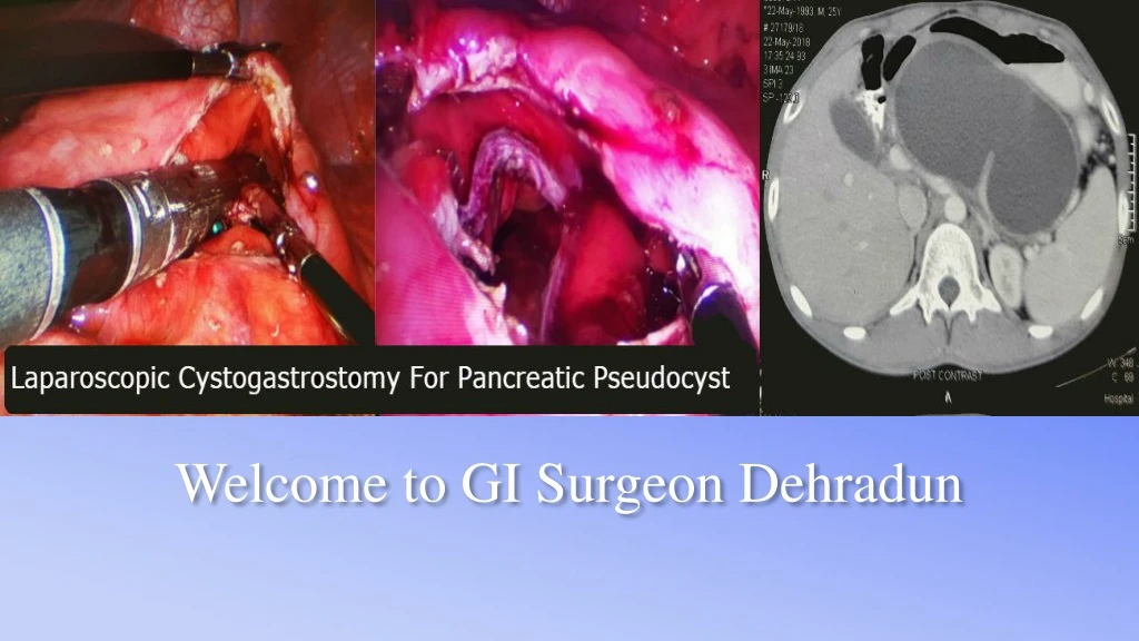 welcome to gi surgeon dehradun
