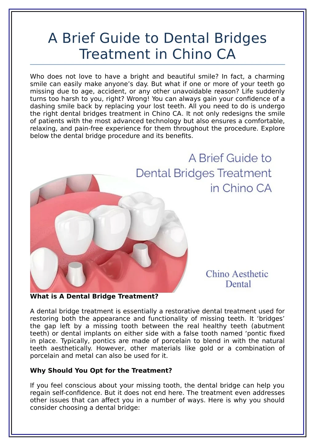 a brief guide to dental bridges treatment