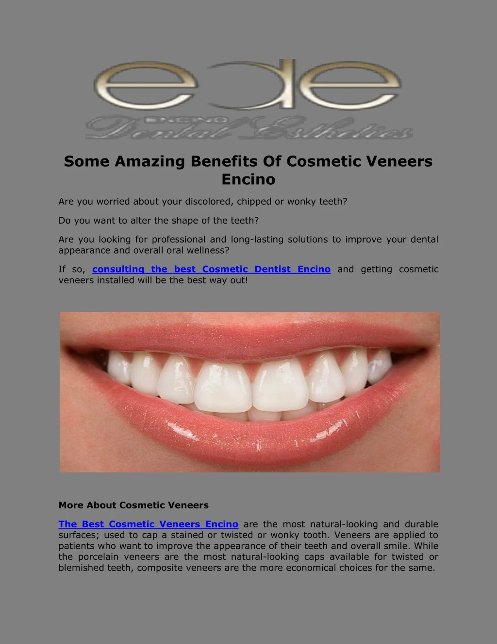 some amazing benefits of cosmetic veneers encino