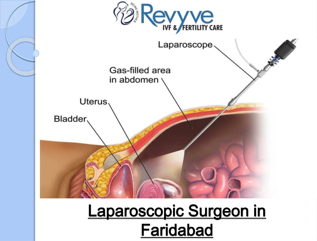 laparoscopic surgeon in faridabad