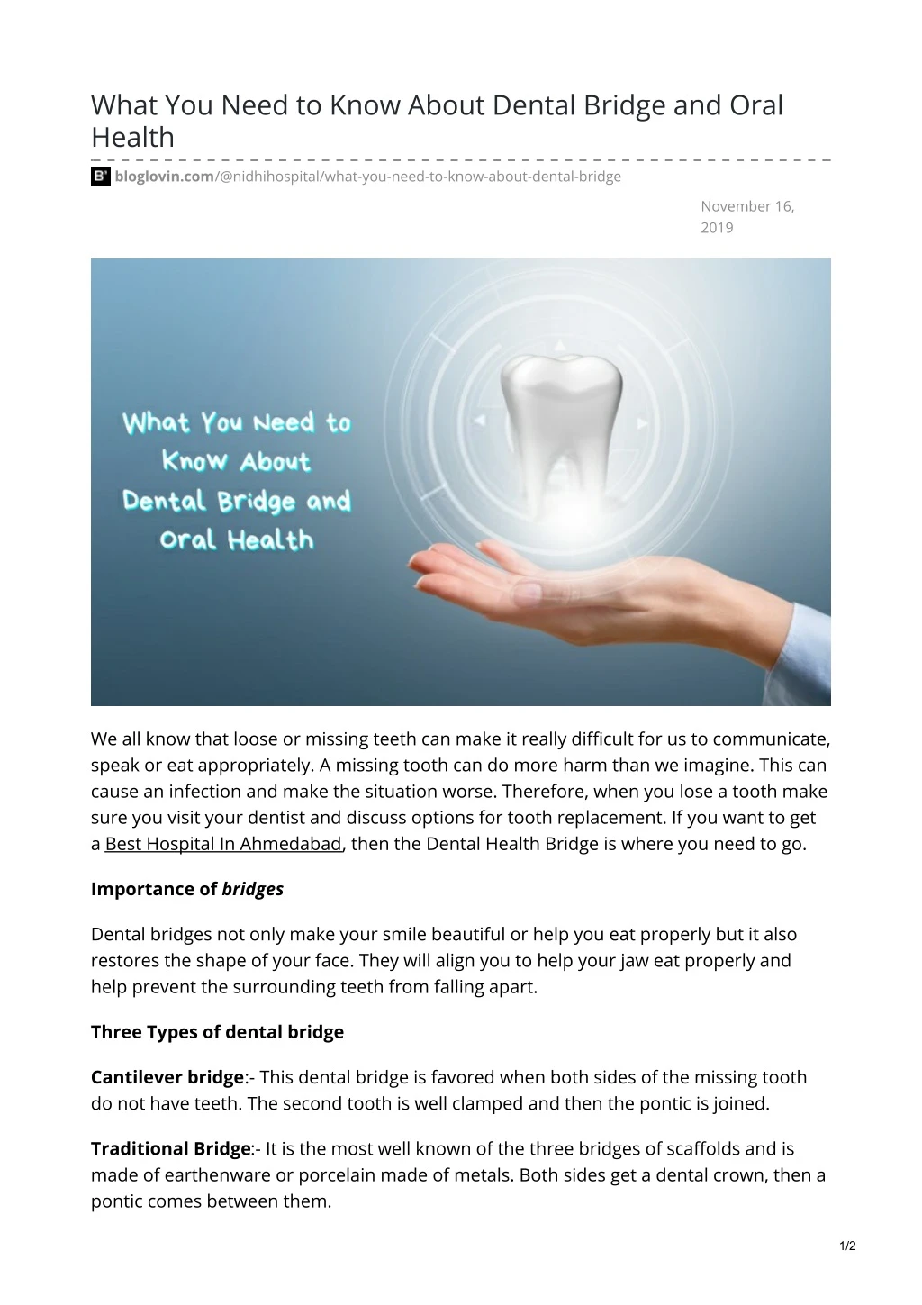 what you need to know about dental bridge