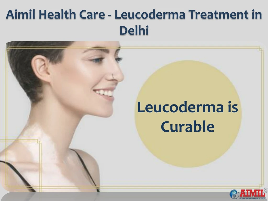 aimil health care leucoderma treatment in delhi