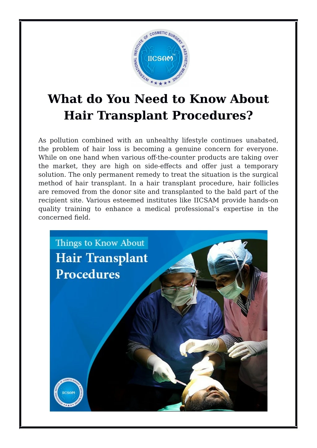 what do you need to know about hair transplant